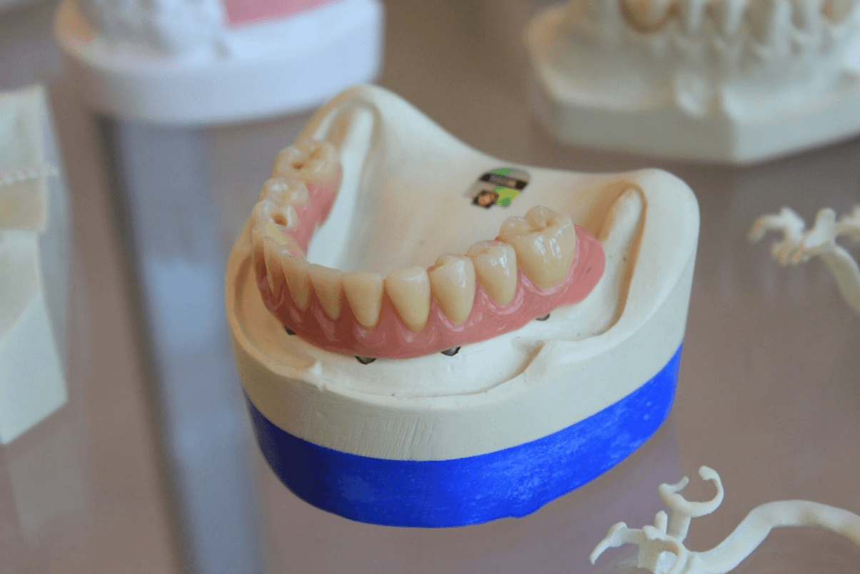 How Often Should I Replace My Dentures?