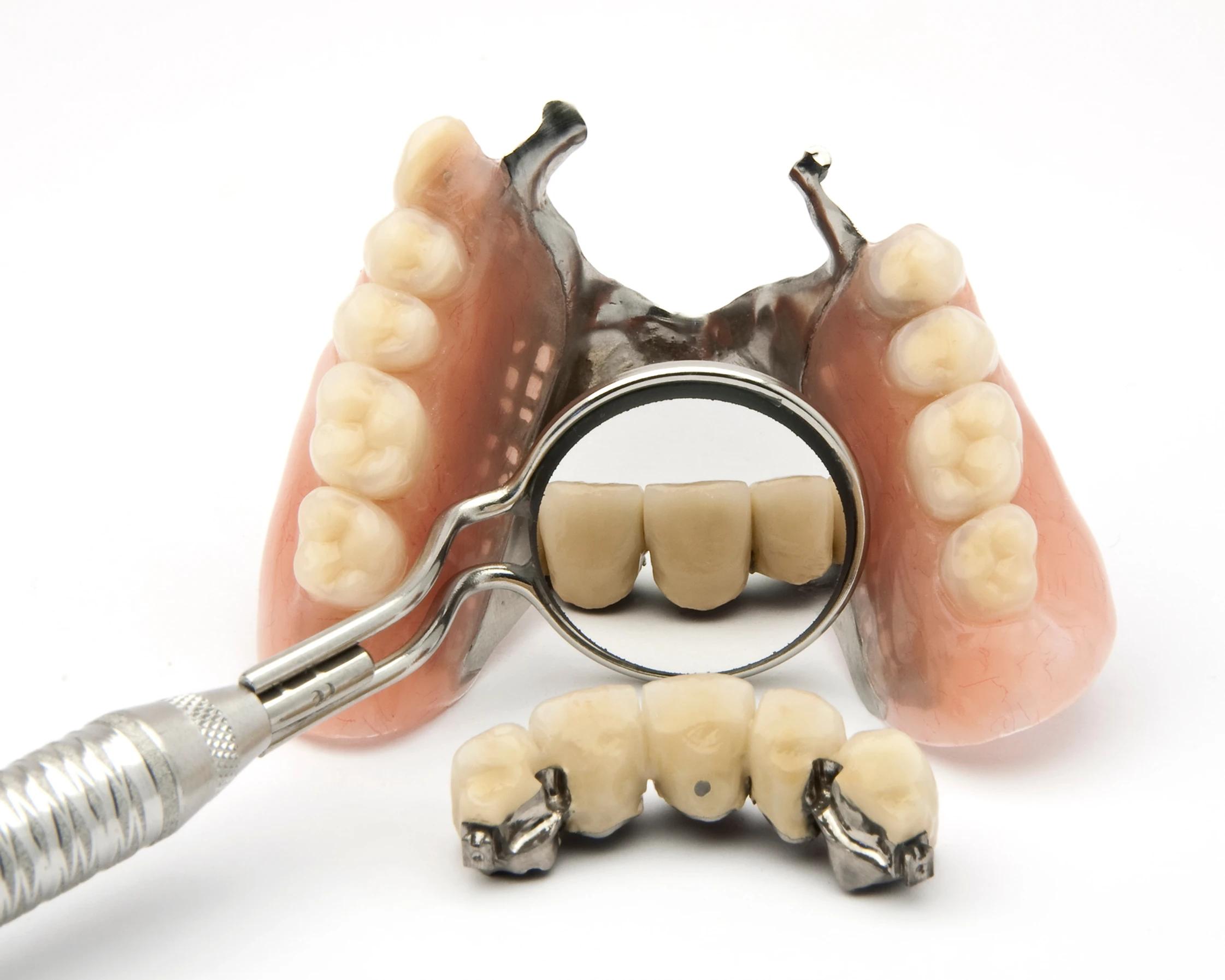 WHAT ARE PRECISION DENTURES?